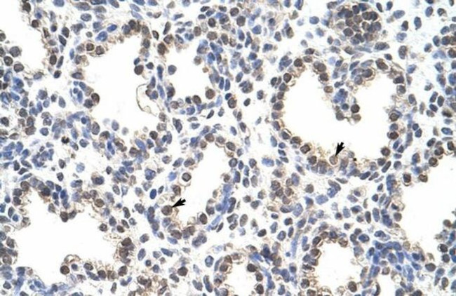 CPSF7 Antibody in Immunohistochemistry (Paraffin) (IHC (P))