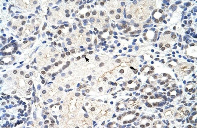 MRM1 Antibody in Immunohistochemistry (Paraffin) (IHC (P))
