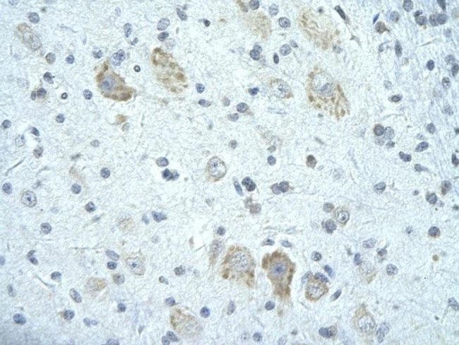 FIP1L1 Antibody in Immunohistochemistry (Paraffin) (IHC (P))