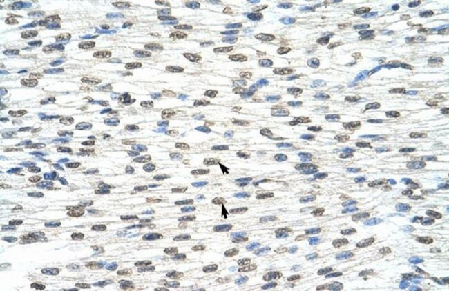 THOC3 Antibody in Immunohistochemistry (Paraffin) (IHC (P))