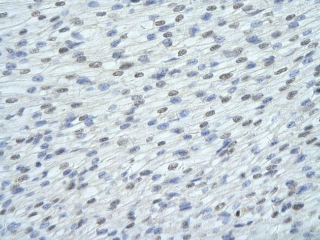 FUSIP1 Antibody in Immunohistochemistry (Paraffin) (IHC (P))