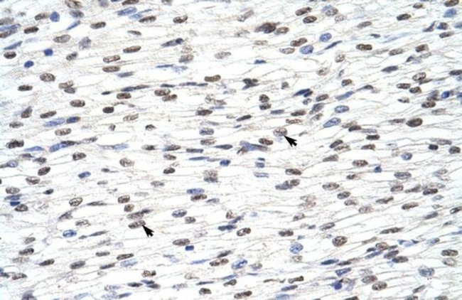 hnRNP LL Antibody in Immunohistochemistry (Paraffin) (IHC (P))