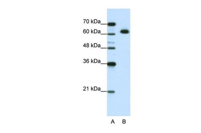 DIS3L2 Antibody in Western Blot (WB)
