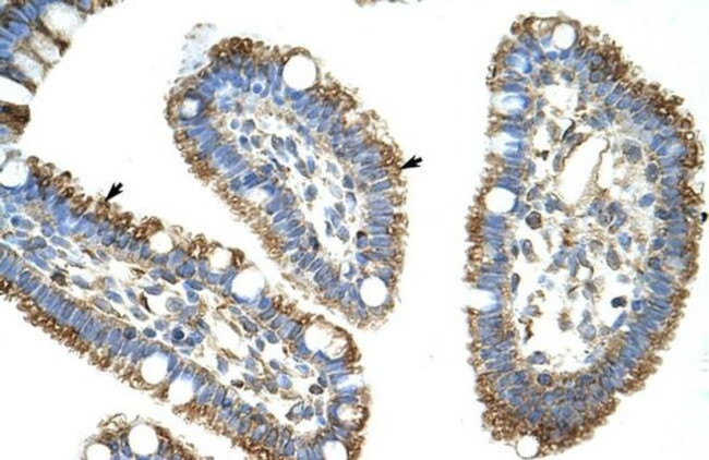 DIS3L2 Antibody in Immunohistochemistry (Paraffin) (IHC (P))