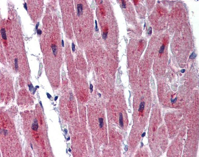 RBM24 Antibody in Immunohistochemistry (IHC)