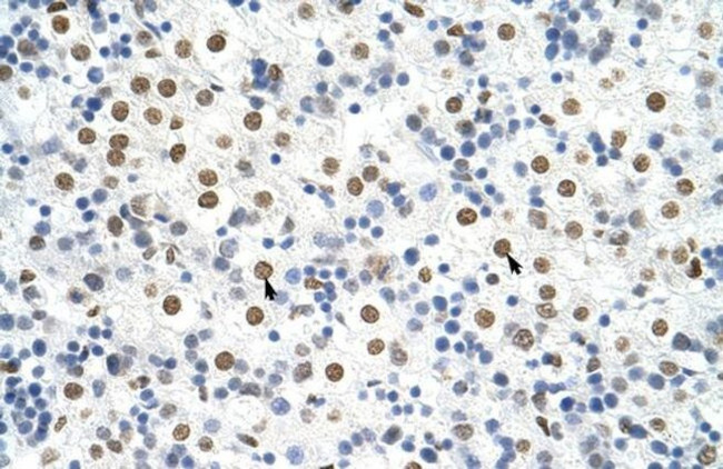 hnRNP A3 Antibody in Immunohistochemistry (Paraffin) (IHC (P))