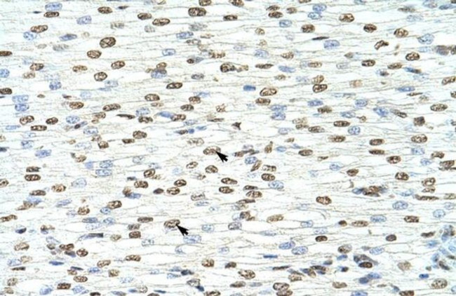 hnRNP A3 Antibody in Immunohistochemistry (Paraffin) (IHC (P))