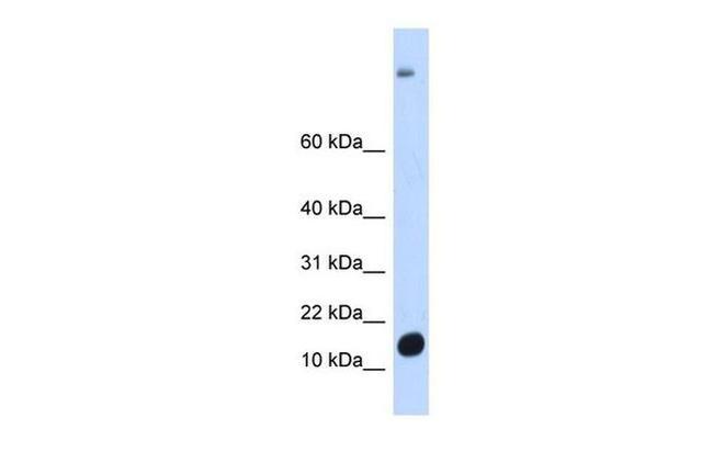 C6orf201 Antibody in Western Blot (WB)