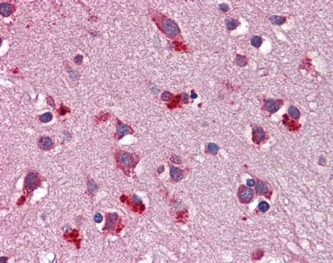 WNT7B Antibody in Immunohistochemistry (IHC)