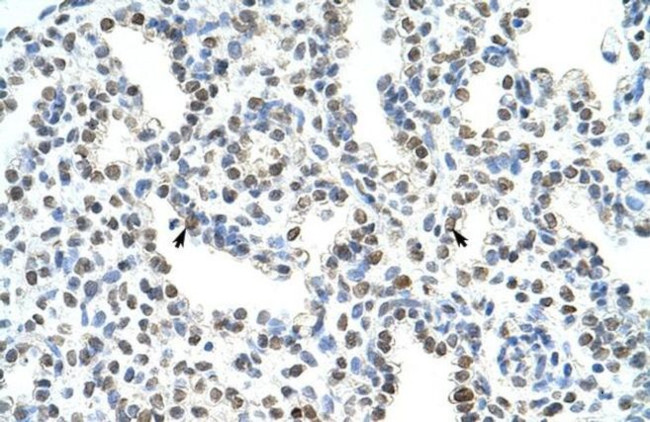 WDR6 Antibody in Immunohistochemistry (Paraffin) (IHC (P))