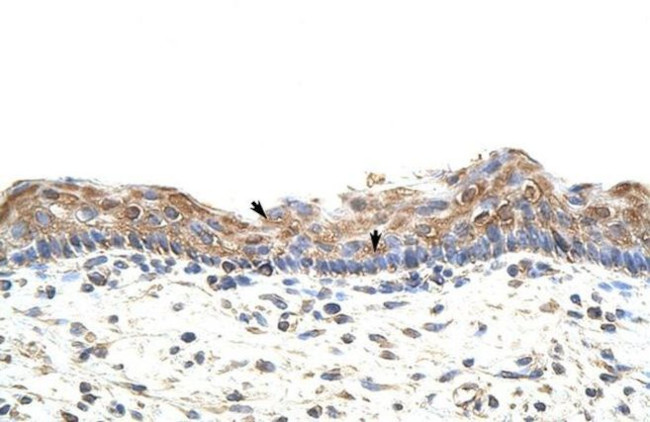 GNB1L Antibody in Immunohistochemistry (Paraffin) (IHC (P))