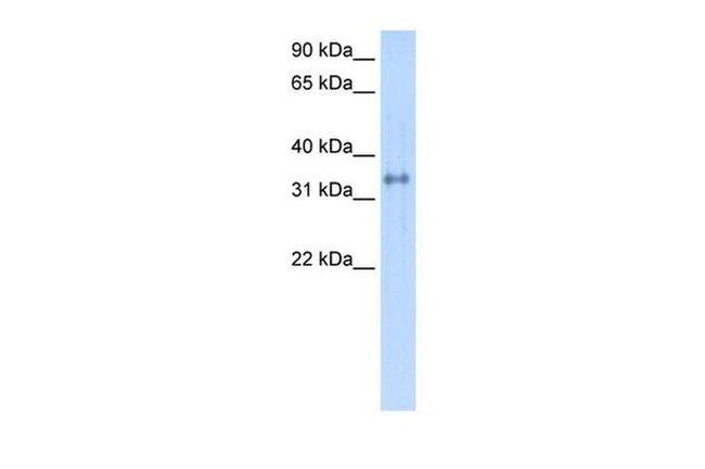 Carbonic Anhydrase IV Antibody in Western Blot (WB)