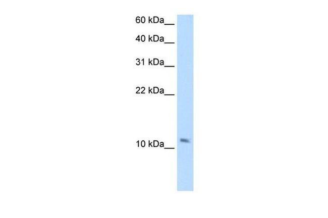 SMPX Antibody in Western Blot (WB)