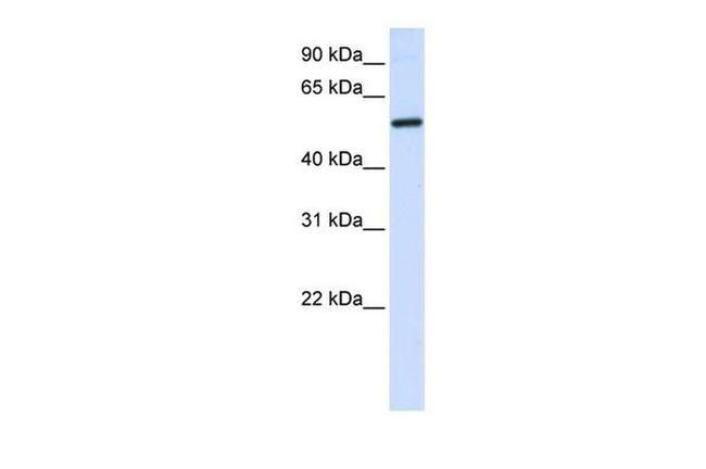 ALAS2 Antibody in Western Blot (WB)
