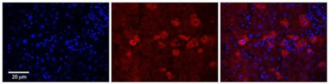 CYP4F3 Antibody in Immunohistochemistry (Paraffin) (IHC (P))