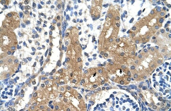 CYP4A22 Antibody in Immunohistochemistry (Paraffin) (IHC (P))
