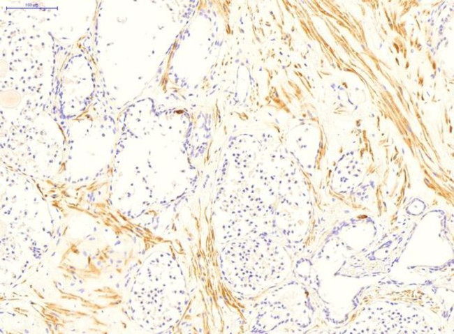 TGM4 Antibody in Immunohistochemistry (IHC)