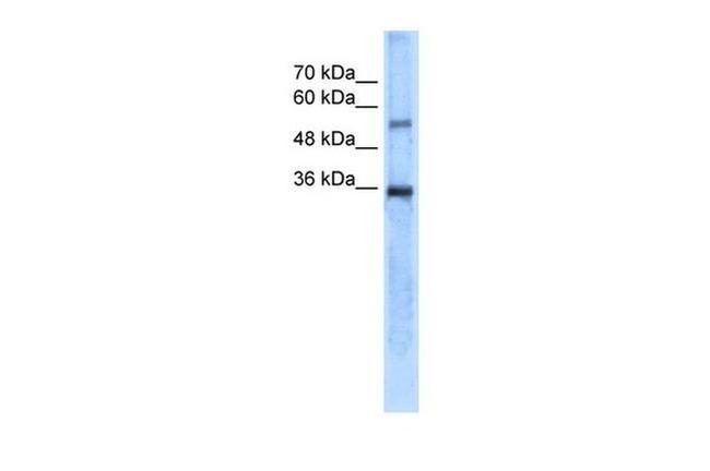 Carbonic Anhydrase VIII Antibody in Western Blot (WB)