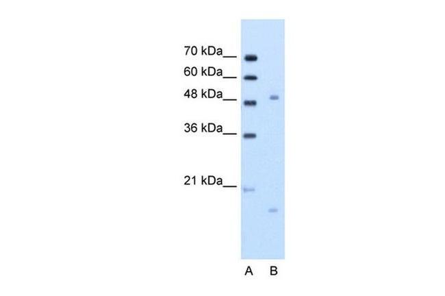 ITGBL1 Antibody in Western Blot (WB)