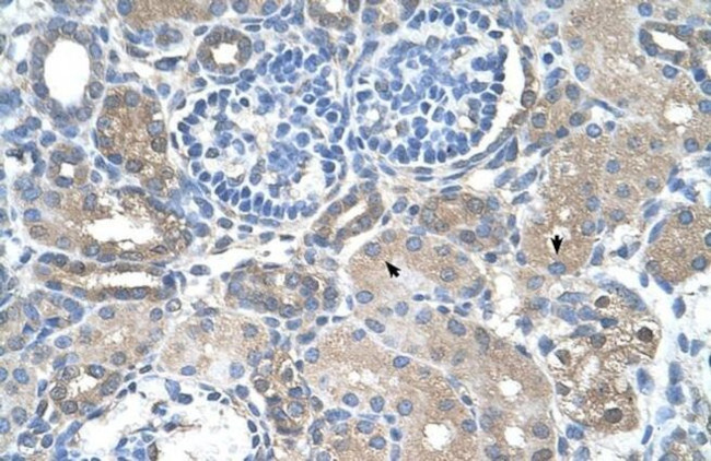 SARDH Antibody in Immunohistochemistry (Paraffin) (IHC (P))