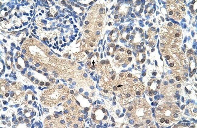 GPR161 Antibody in Immunohistochemistry (Paraffin) (IHC (P))