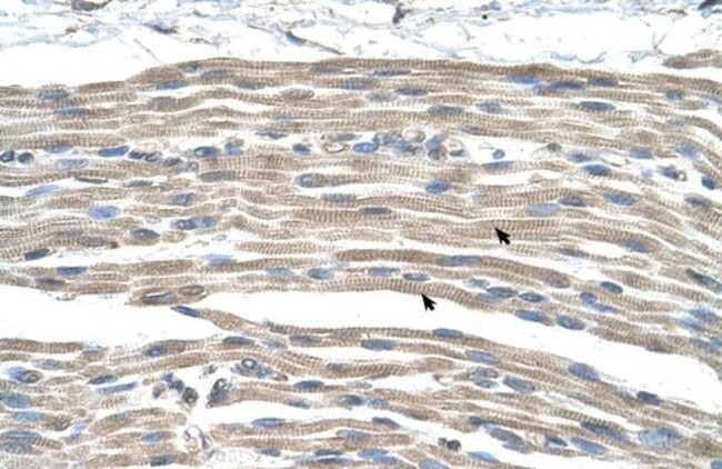GPR161 Antibody in Immunohistochemistry (Paraffin) (IHC (P))