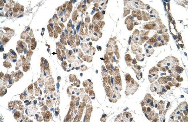 ITGB1BP2 Antibody in Immunohistochemistry (Paraffin) (IHC (P))
