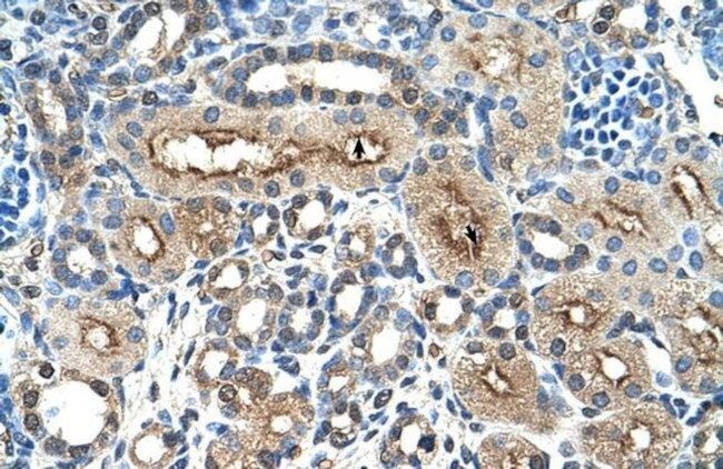 CD299 (DC-SIGN/L) Antibody in Immunohistochemistry (IHC)