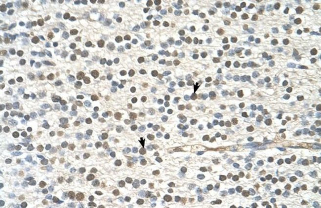 GAPVD1 Antibody in Immunohistochemistry (IHC)