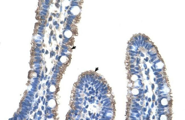 TMEM8B Antibody in Immunohistochemistry (IHC)
