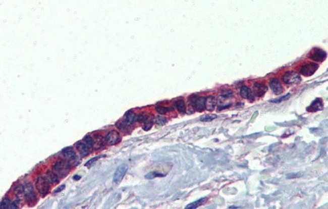 PLUNC Antibody in Immunohistochemistry (IHC)