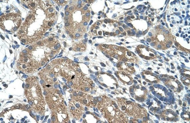 C21orf7 Antibody in Immunohistochemistry (IHC)