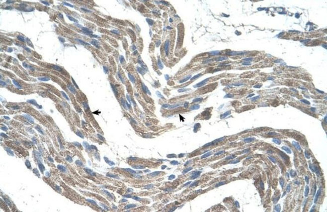 GPR161 Antibody in Immunohistochemistry (IHC)