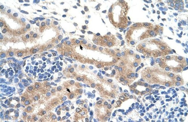 FAM174B Antibody in Immunohistochemistry (IHC)