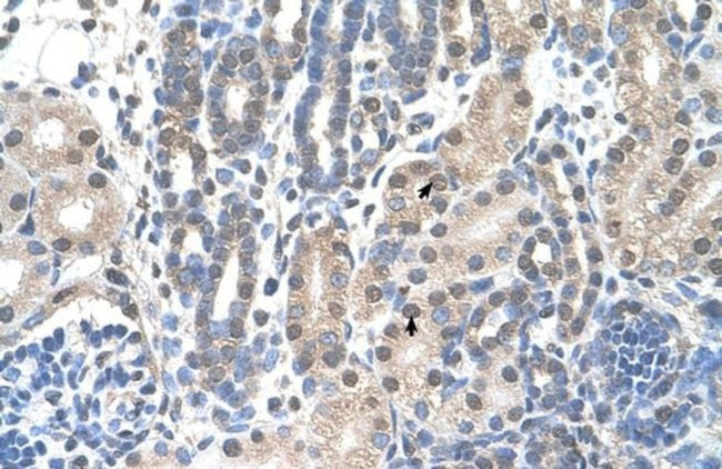 FAM174B Antibody in Immunohistochemistry (IHC)