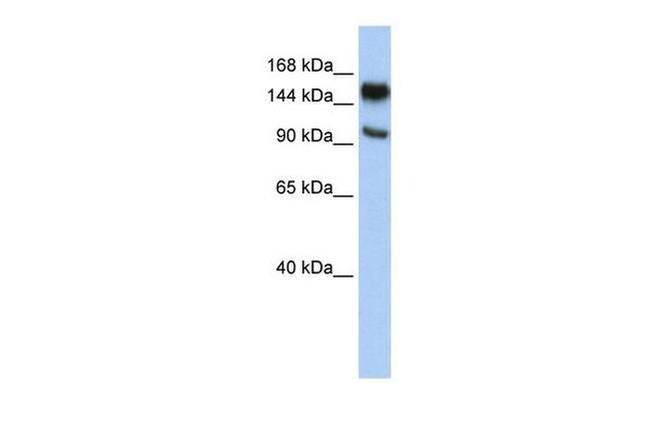 PARP10 Antibody in Western Blot (WB)