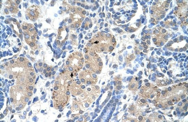 FOXR2 Antibody in Immunohistochemistry (IHC)