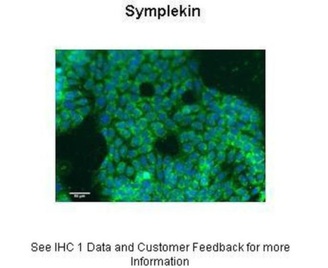 SYMPK Antibody in Immunocytochemistry (ICC/IF)