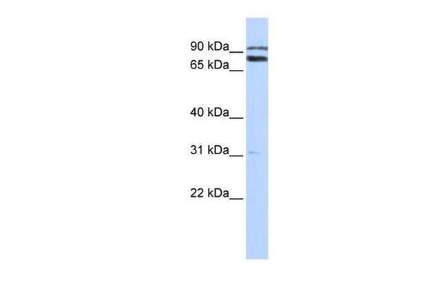 TRIM67 Antibody in Western Blot (WB)