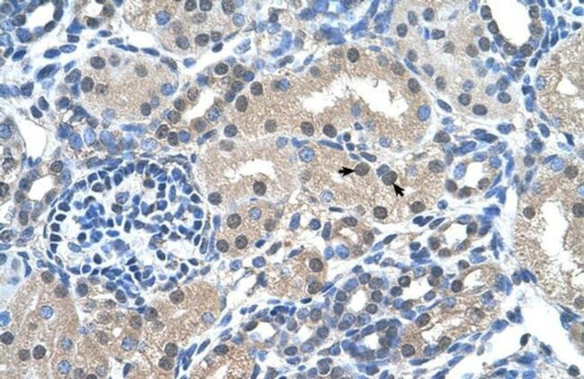 FKBP6 Antibody in Immunohistochemistry (IHC)