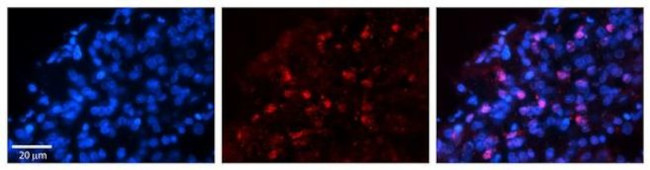 WWP1 Antibody in Immunohistochemistry (Paraffin) (IHC (P))