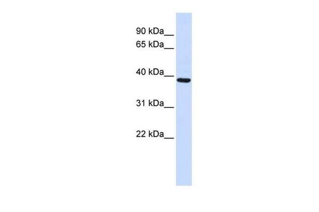 FBXO24 Antibody in Western Blot (WB)