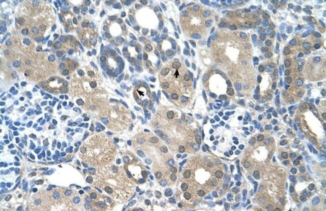 FBXO25 Antibody in Immunohistochemistry (IHC)