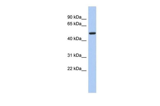 FBXO3 Antibody in Western Blot (WB)