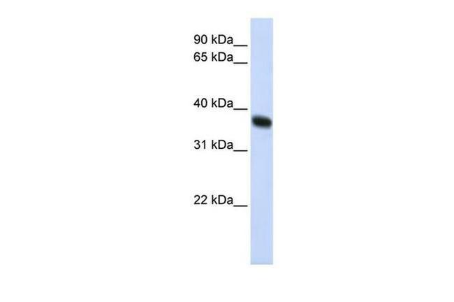 RNF115 Antibody in Western Blot (WB)