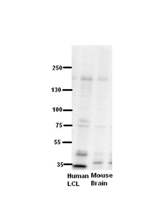 ZNF294 Antibody in Western Blot (WB)