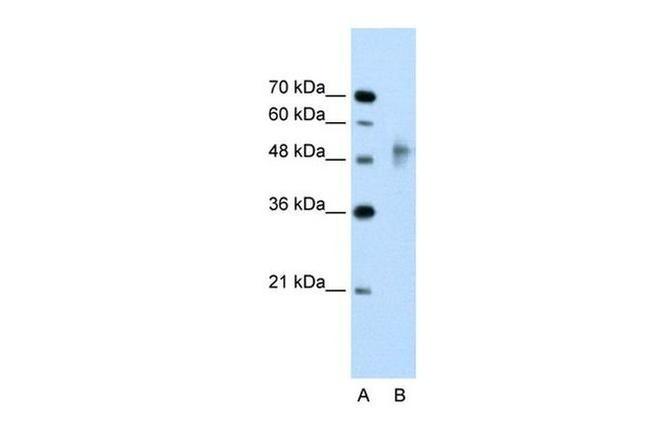 RNF38 Antibody in Western Blot (WB)