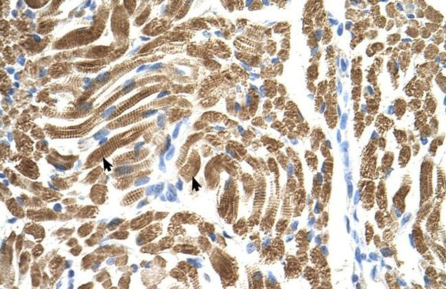 PEX10 Antibody in Immunohistochemistry (IHC)