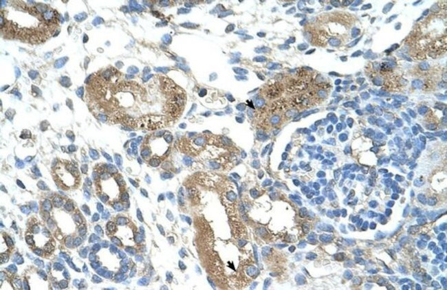 TRIM59 Antibody in Immunohistochemistry (IHC)
