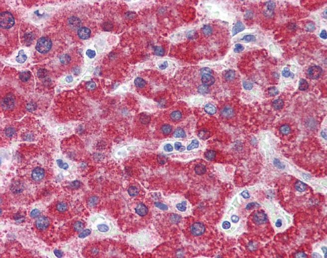 Monoamine Oxidase B Antibody in Immunohistochemistry (IHC)